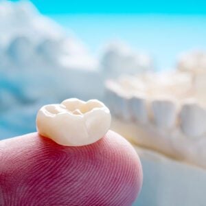 same-day crowns dental crowns Pomona dentist
