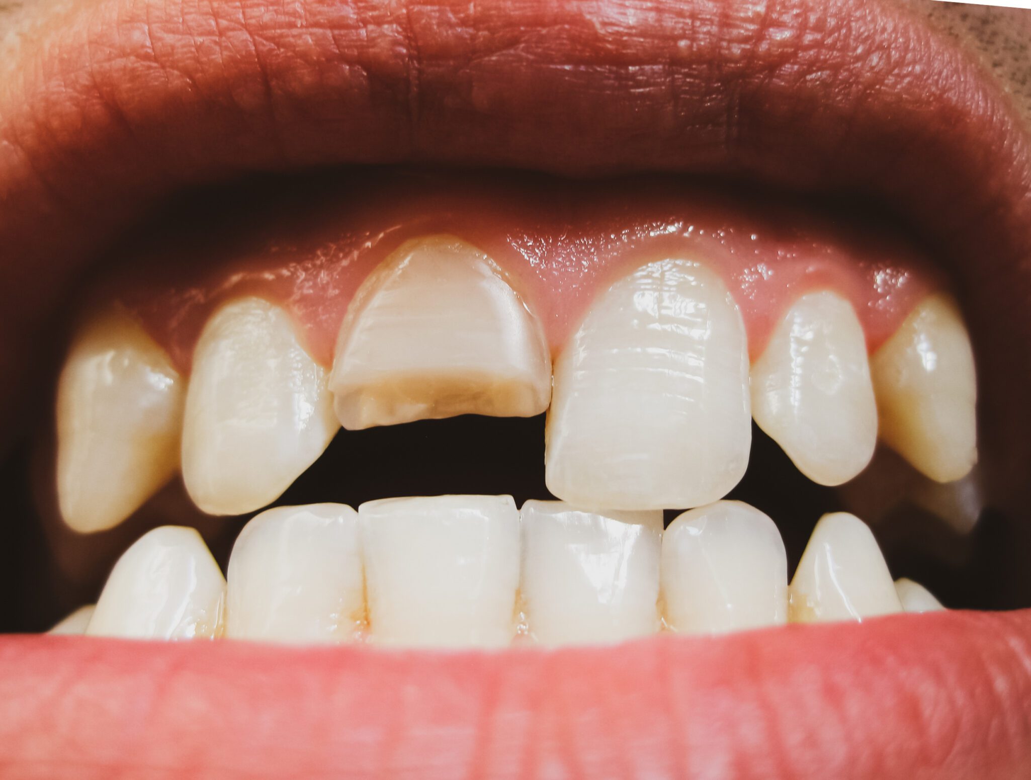 Preventative Dentistry in Pomona
